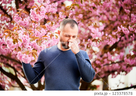 Man allergic suffering from seasonal allergy at spring in blossoming garden at springtime. Bearded young man sneezing and having runny nose in front of blooming tree. Spring allergy concept. Man allergic suffering from seasonal allergy at spring in blossoming garden at springtime. Bearded young man sneezing and having runny nose in front of blooming tree. Spring allergy concept. 123378578