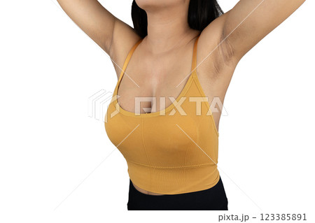 Dark armpit problems of women after pregnancy and skin care and beauty concepts isolated on white background with clipping paths. Dark armpit problems of women after pregnancy and skin care and beauty concepts isolated on white background with clipping paths. 123385891
