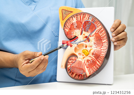 Kidney disease, Chronic kidney disease ckd, Doctor hold human model to treat and study in hospital. Kidney disease, Chronic kidney disease ckd, Doctor hold human model to treat and study in hospital. 123431256