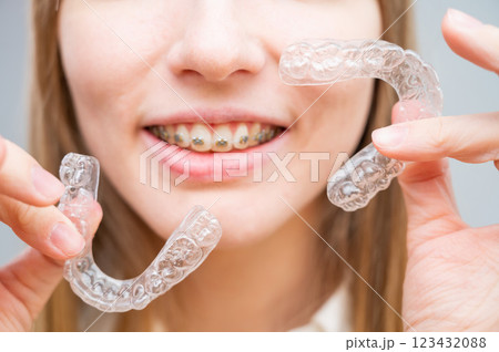 Woman with braces on her teeth holding and removable transparent aligners.  123432088