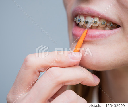 Unrecognizable Caucasian woman cleans braces with a brush. Close-up of female teeth with brackets 123432099