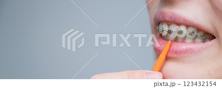 Unrecognizable Caucasian woman cleans braces with a brush. Close-up of female teeth with brackets 123432154