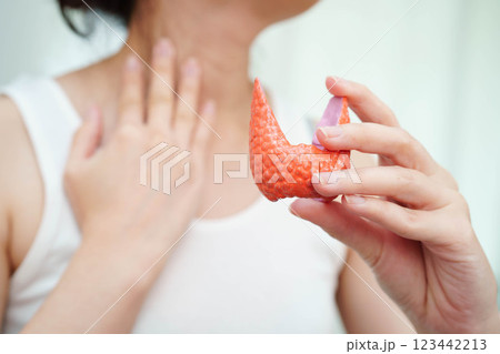 Hyperthyroidism, Overactive Thyroid, Thyroid Lymphoma, Asian woman with thyroid gland human anatomy model. Hyperthyroidism, Overactive Thyroid, Thyroid Lymphoma, Asian woman with thyroid gland human anatomy model. 123442213
