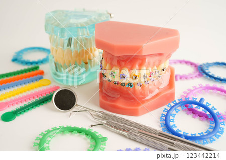 Orthodontic ligatures rings and ties, elastic rubber bands on orthodontic braces, model for dentist studying about dentistry. Orthodontic ligatures rings and ties, elastic rubber bands on orthodontic braces, model for dentist studying about dentistry. 123442214