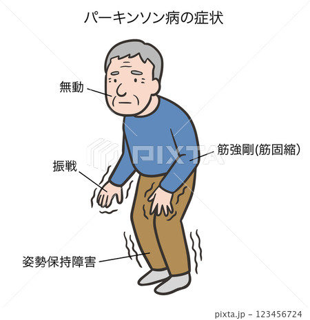 パーキンソン病の四大症状 123456724