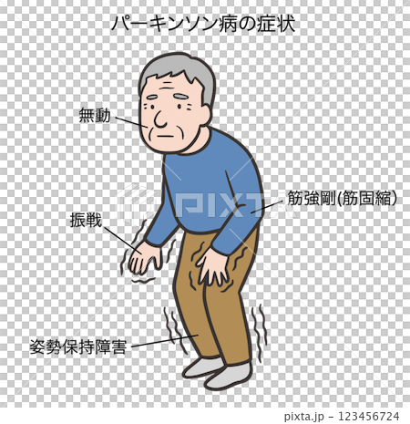 パーキンソン病の四大症状 123456724