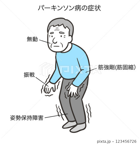 パーキンソン病の四大症状2 123456726