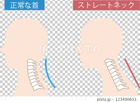 直頸前後 123490633