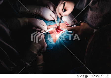 A medical team performing a detailed surgery, utilizing specialized instruments 123514563