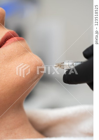 Skin treatment procedure with aesthetic injector in a clinical setting Skin treatment procedure with aesthetic injector in a clinical setting 123518525