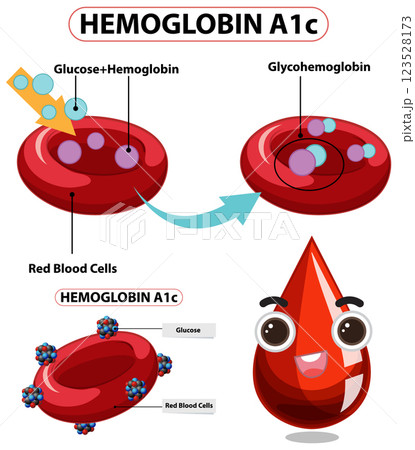 Understanding Hemoglobin A1c in Blood 123528173
