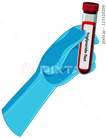 Medical Blood Test Illustration 123528206