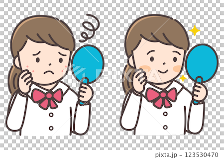 Before and after illustration of a female junior high school student suffering from acne 123530470