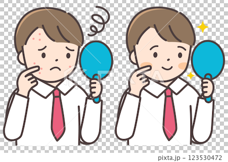 Before and after illustration of a male junior high school student suffering from acne Before and after illustration of a male junior high school student suffering from acne 123530472