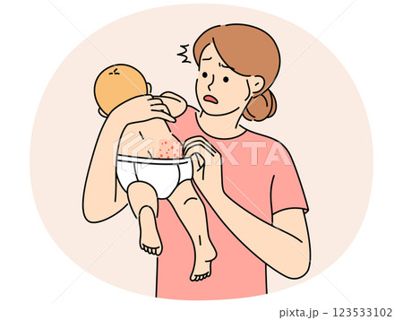 Anxious young mother confused with baby body rash 123533102