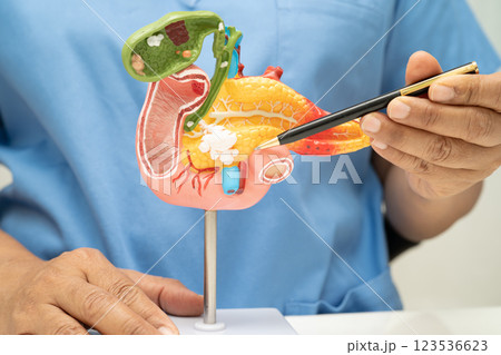Pancreatitis, pancreatic cancer, Asian doctor with pancreas, gallbladder and bile duct human anatomy model at hospital. Pancreatitis, pancreatic cancer, Asian doctor with pancreas, gallbladder and bile duct human anatomy model at hospital. 123536623