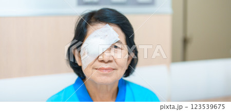 Elderly Woman with eye protective shield after eye surgery. Eye disease, Cataract,  Glaucoma, Age Related Macular Degeneration, Diabetic Retinopathy, Vitreous, Lasik, World Glaucoma day and health 123539675