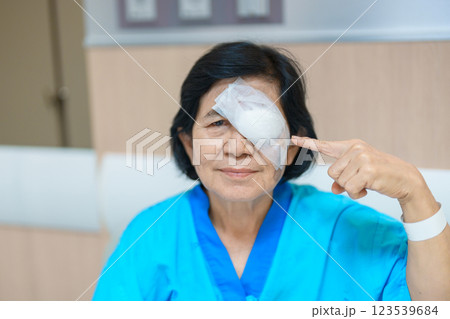 Elderly Woman with eye protective shield after eye surgery. Eye disease, Cataract,  Glaucoma, Age Related Macular Degeneration, Diabetic Retinopathy, Vitreous, Lasik, World Glaucoma day and health 123539684