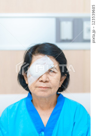 Elderly Woman with eye protective shield after eye surgery. Eye disease, Cataract, Glaucoma, Age Related Macular Degeneration, Diabetic Retinopathy, Vitreous, Lasik, World Glaucoma day and health Elderly Woman with eye protective shield after eye surgery. Eye disease, Cataract, Glaucoma, Age Related Macular Degeneration, Diabetic Retinopathy, Vitreous, Lasik, World Glaucoma day and health 123539685