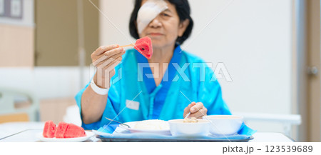 Senior Woman eating food after eye surgery in hospital . Eye disease, Cataract,  Glaucoma, Age Related Macular Degeneration, Diabetic Retinopathy, Lasik, World Glaucoma day and health treatment 123539689