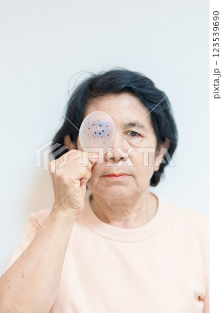 Elderly Woman with eye protective shield after eye surgery. Eye disease, Cataract,  Glaucoma, Age Related Macular Degeneration, Diabetic Retinopathy, Vitreous, Lasik, World Glaucoma day and health 123539690