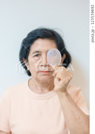 Elderly Woman with eye protective shield after eye surgery. Eye disease, Cataract,  Glaucoma, Age Related Macular Degeneration, Diabetic Retinopathy, Vitreous, Lasik, World Glaucoma day and health 123539692