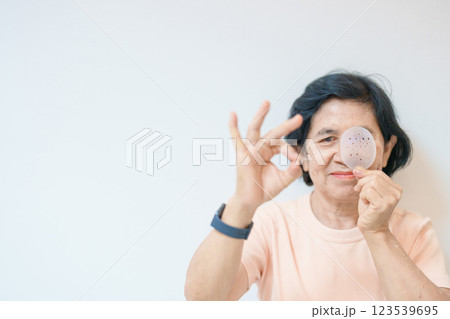 Elderly Woman with eye protective shield after eye surgery. Eye disease, Cataract,  Glaucoma, Age Related Macular Degeneration, Diabetic Retinopathy, Vitreous, Lasik, World Glaucoma day and health 123539695
