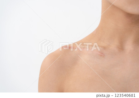 傷口　怪我　縫い合わせ　傷痕 123540681