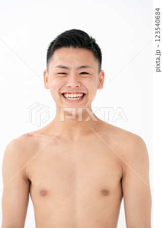 傷口 怪我 縫い合わせ 傷痕 笑顔 傷口 怪我 縫い合わせ 傷痕 笑顔 123540684