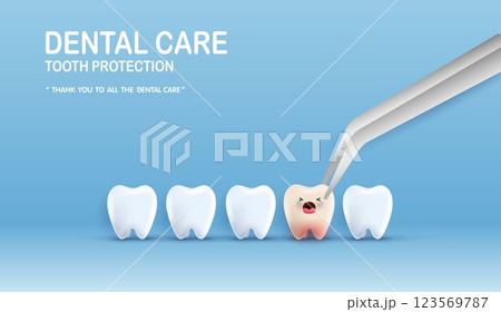 Dental care illustration set. dentists treat tooth decay to avoid pain when chewing. tooth decay treatment concept. remove plaque, treat tooth decay. medical apps, websites and hospital. vector. 123569787