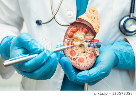 Kidney disease, Chronic kidney disease ckd, Doctor hold human model to treat and study in hospital. 123572355