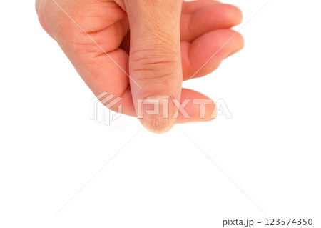 爪に縦筋  123574350