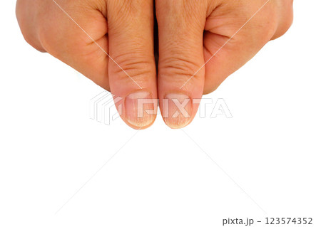 爪に縦筋  123574352