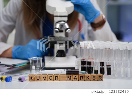 Detailed Laboratory Analysis of Tumor Markers Observed Under Microscope Examination 123582459