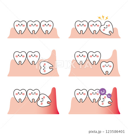 かわいい歯のキャラクターのイラストセット かわいい歯のキャラクターのイラストセット 123586401