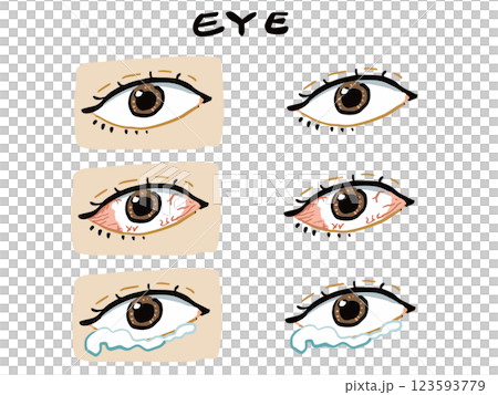 色々な目(涙、充血)のリアルな手描き風イラストセット 123593779