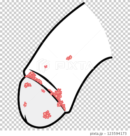 Genital warts: Bumps on the male genitals Genital warts: Bumps on the male genitals 123594173