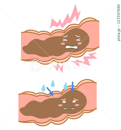 大腸内で詰まった便に水分を与えるイラストセット 123597680