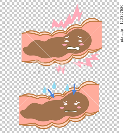 大腸内で詰まった便に水分を与えるイラストセット 123597680