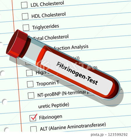Fibrinogen Blood Test Illustration Fibrinogen Blood Test Illustration 123599292