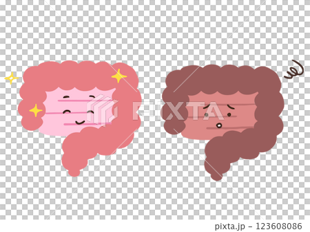 元気な腸と調子が悪い腸　腸内環境についてのイラスト 123608086