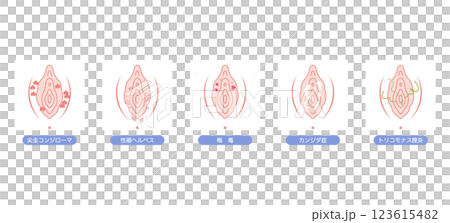 Disorders of the female external genitalia Disorders of the female external genitalia 123615482