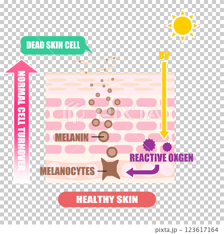Illustration of blemishes shown on cross-section of skin Illustration of blemishes shown on cross-section of skin 123617164