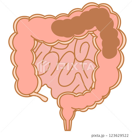 順調に排便を行っている大腸 123629522
