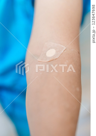 Elderly asian Patient Woman with medical patch plaster after blood test in hospital. Diagnose, illness, treatment, Insurance, Healthcare, medical Examination, Blood donation and World Blood Donor Day Elderly asian Patient Woman with medical patch plaster after blood test in hospital. Diagnose, illness, treatment, Insurance, Healthcare, medical Examination, Blood donation and World Blood Donor Day 123647698