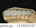ジルコニア模型 123665147