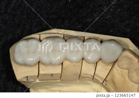ジルコニア模型 ジルコニア模型 123665147