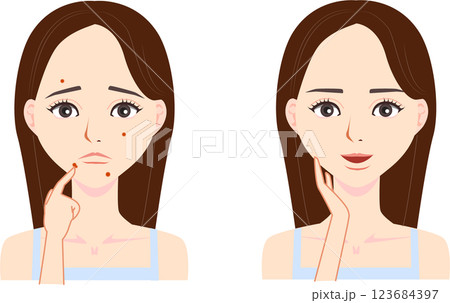ニキビに悩む女性のイラスト 123684397