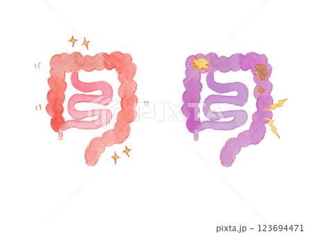 健康な腸と不健康な腸の水彩イラスト 123694471