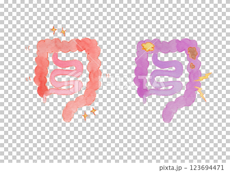 健康な腸と不健康な腸の水彩イラスト 123694471